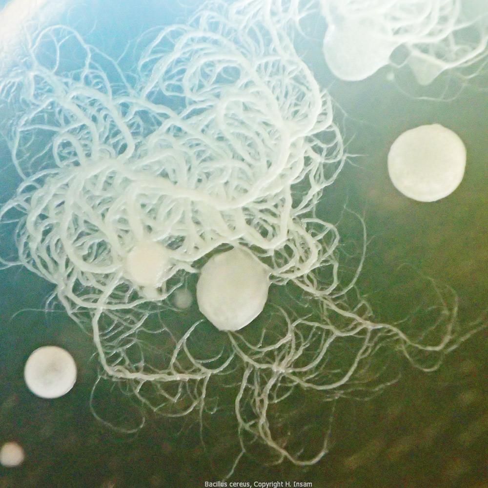 Bacillus cereus I mikrobalpina